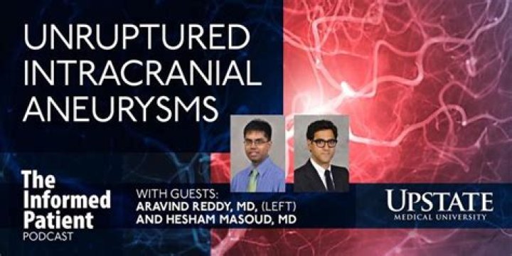 Dr. Aravind Reddy, MD – Syracuse, NY