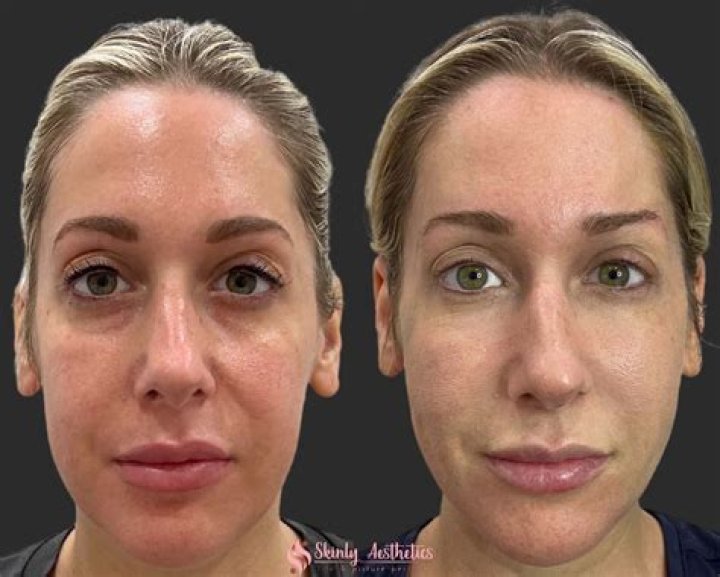 
Bianca Kajlich Plastic Surgery Photos, Botox And Lip Fillers, Has She Done Nose Job? 