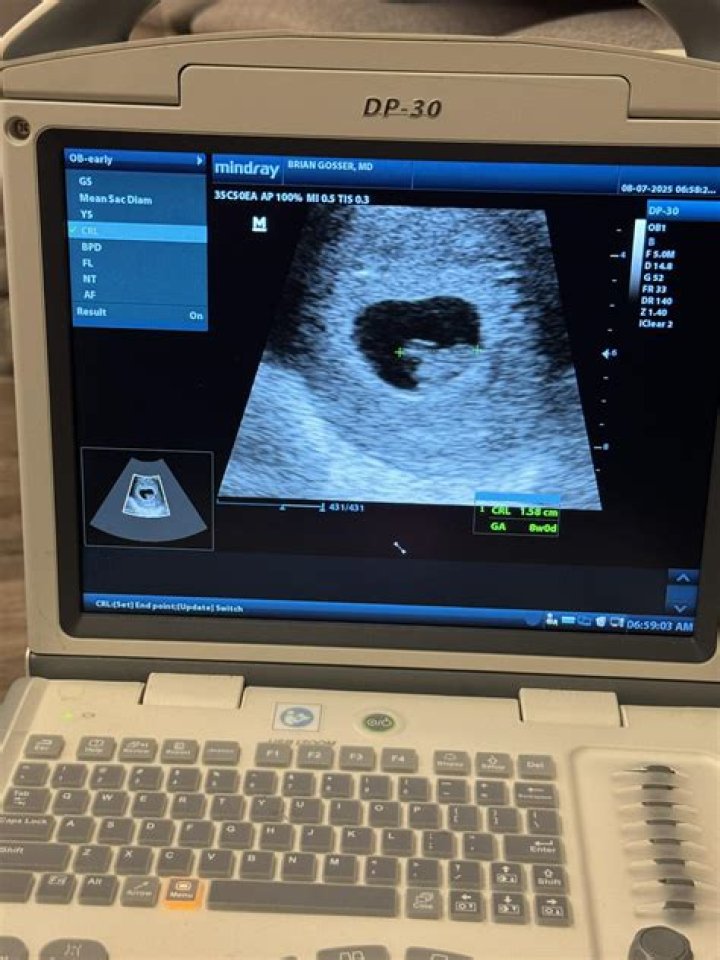 Dr. Brian Gosser, MD – Saint Louis, MO