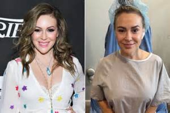 Clare Crawley Is Getting Her Implants Removed – Here’s Why!