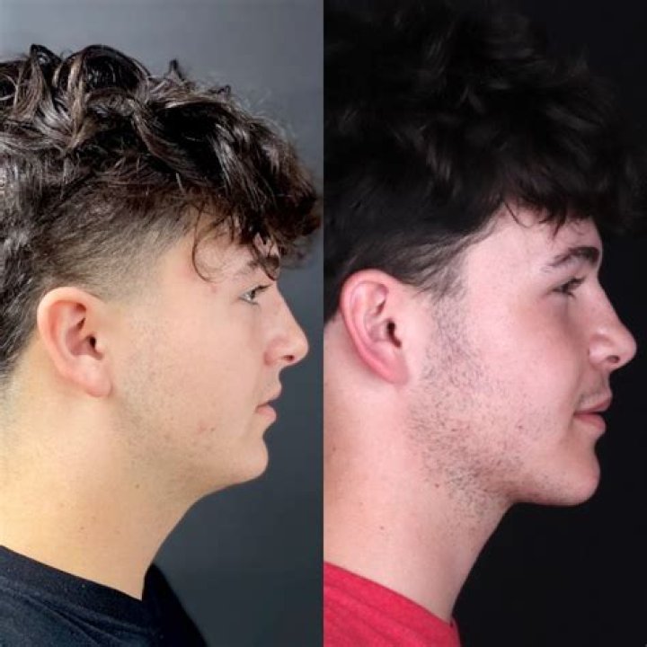 Dr. David Alfi, MD – Houston, TX