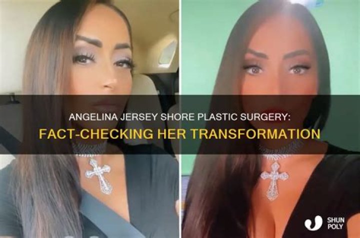 Did Lauren From Jersey Shore Get Plastic Surgery? – Celebrity