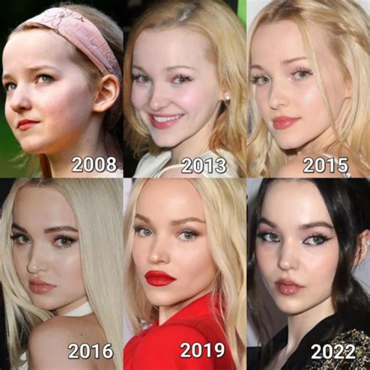 Dove Cameron Plastic Surgery: Cameron's  Barbie Doll Appearance Explored!