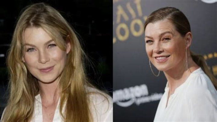 Has Meredith Marks Undergone Plastic Surgery? Face Before And After Photos
