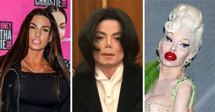 
Has Richard Lewis had Plastic Surgery? Who is Richard Lewis? 
