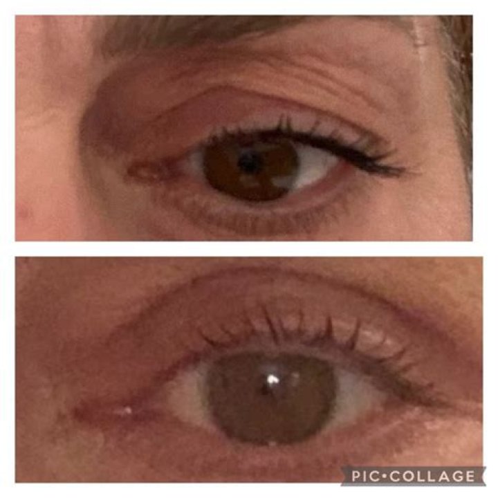 Dr. Ira Vidor, MD – Newport Beach, CA