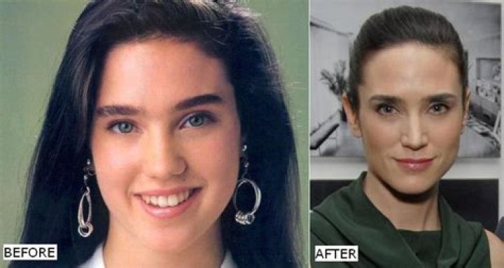 Jennifer Connelly Plastic Surgery Before and After