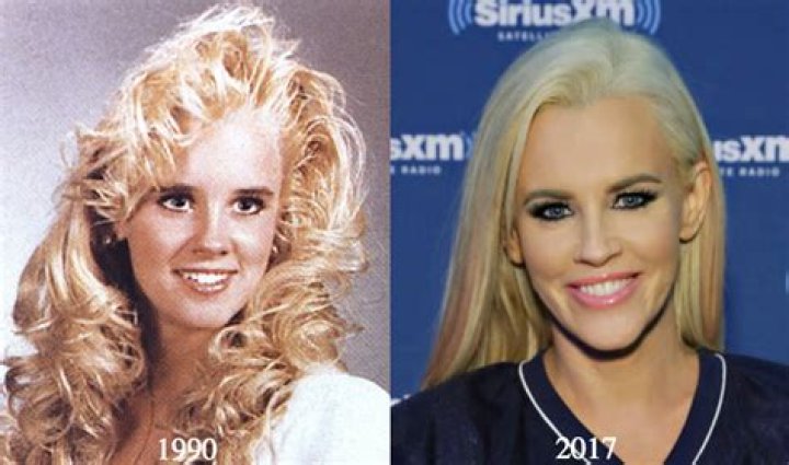 Jenny McCarthy Plastic Surgery: The Truth About Her Cosmetic Enhancements