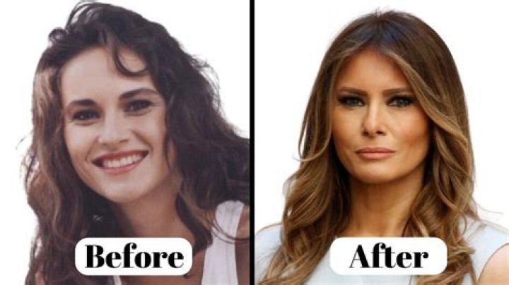 Jodie Joe Before And After Surgery Photos On Instagram, What Surgery Did She Have?