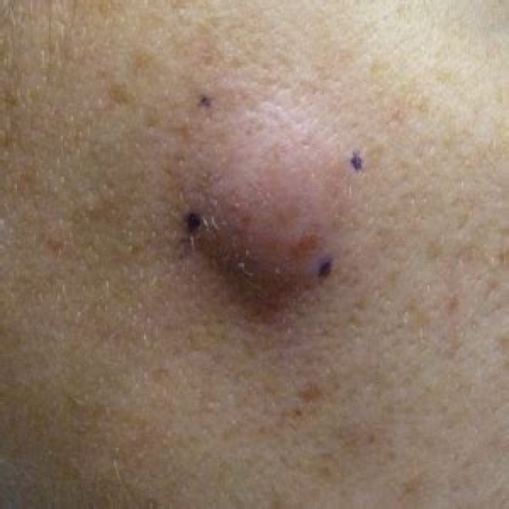 Dr. Justin Grubbs, MD – San Francisco, CA