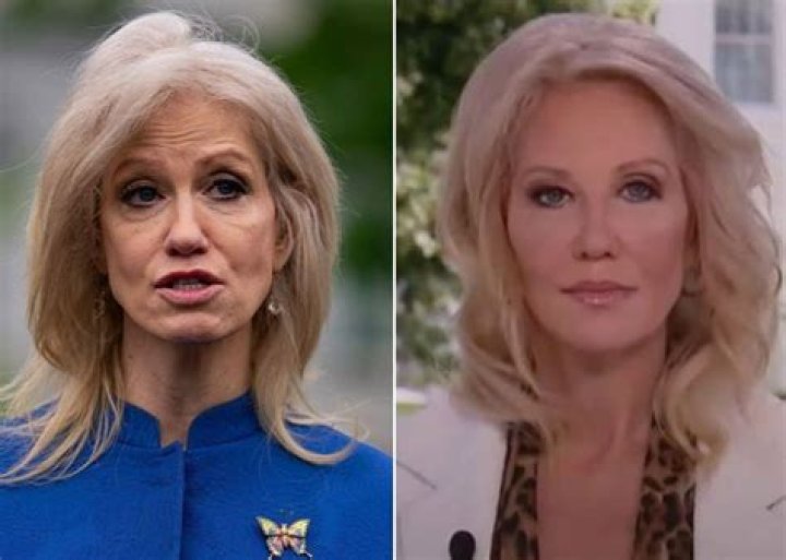 Kellyanne Conway Is Gorgeous After Glow-Up — Did She Have Plastic Surgery?