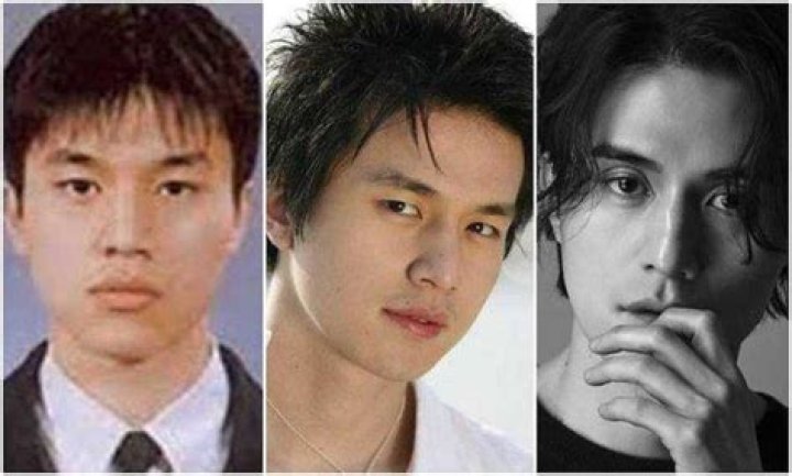 Lee Dong Wook Plastic Surgery: Unveiling Lee Dong Wook's Eyelid Evolution and the Plastic Surgery Debate