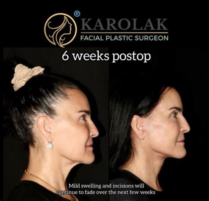 Dr. Mark Karolak, DO – Wall, NJ