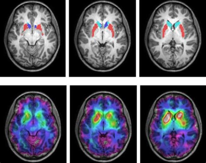 Nergess Gashti – Cumberland, IN