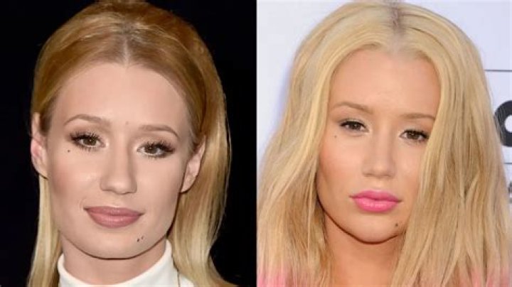 Some Fans Worry Iggy Azalea May Become Suicidal After Media Backlash From Dancer’s Seizure