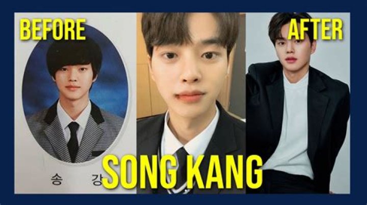 Song Kang Plastic Surgery: Song Kang's Attractive Looks Appealing Fans!