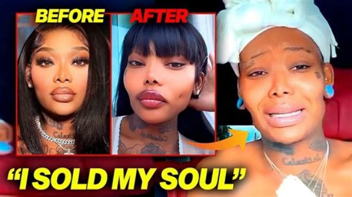 Summer Walker Plastic Surgery: The Musical Sensation's Transformative Journey