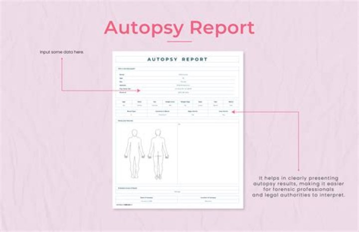 Takeoff autopsy report: Which parts of Takeoff’s body was shot?