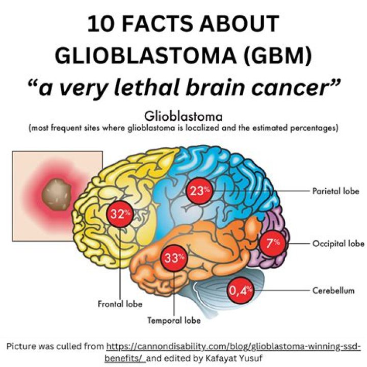 Ty Fondren Dies From Glioblastoma Cancer – Montgomery, Alabama, Resident