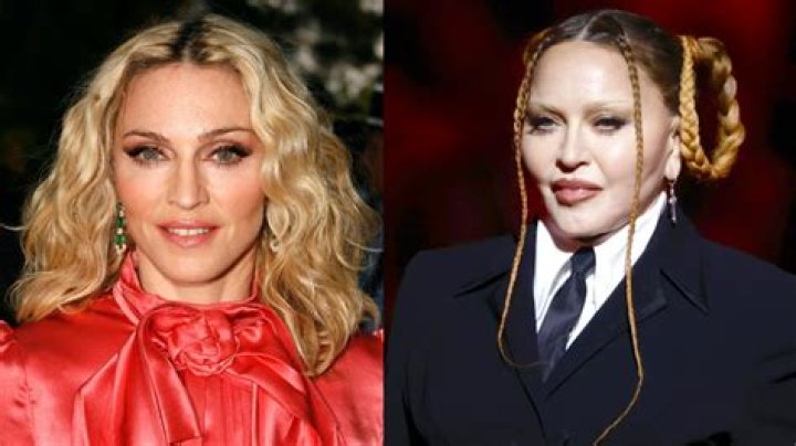What did Madonna do to her face? Her before and after photo, explained