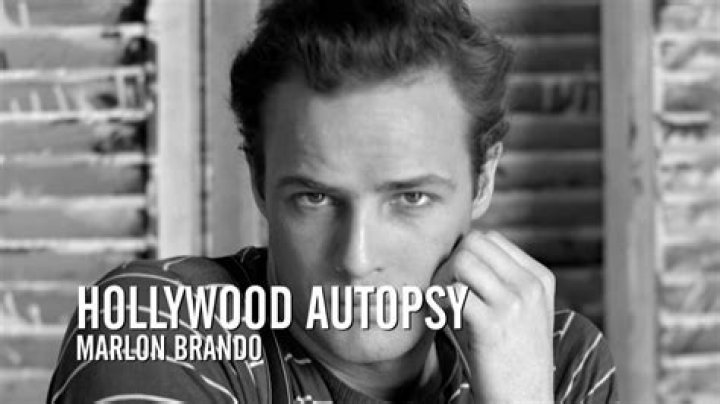 What did Marlon Brando die from? Autopsy revealed