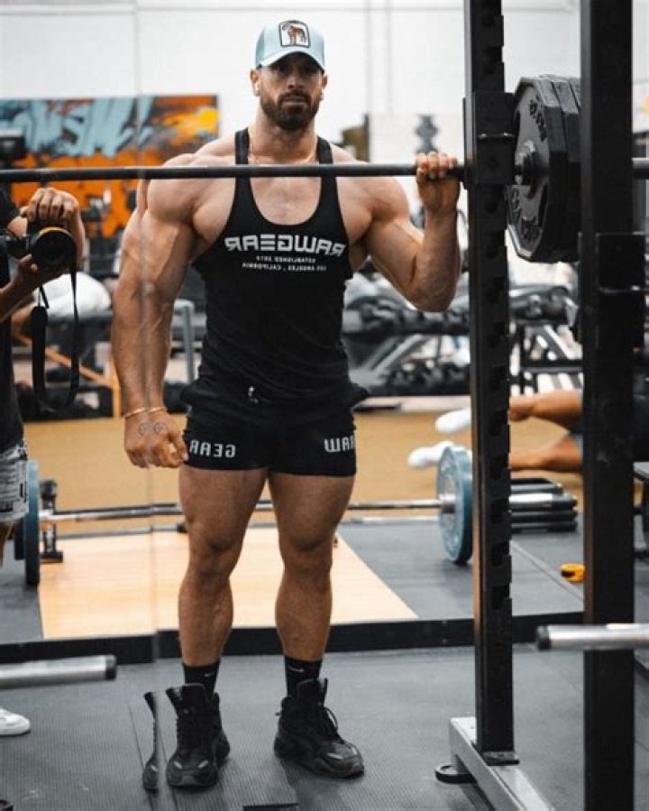 
What Happened To Bradley Martyn’s Face? Stitches And Scars Mark 