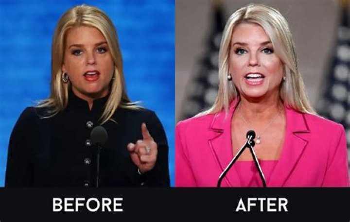 What Happened To Pam Hupp Neck? Facelift Story On Dateline Episode