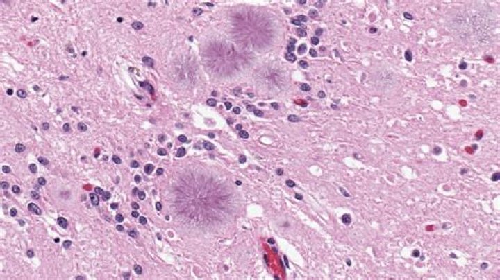 Dr. Wun-Ju Shieh, MD – Atlanta, GA